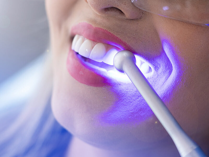 Imagem da campanha Clareamento Dental Coletivo em Canoas